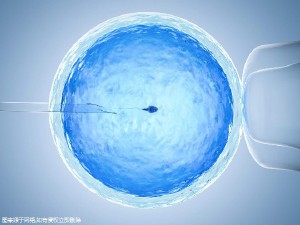 着床前診断 PGT